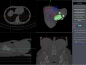 UPDATE:  Pathfinder Therapeutics is back on the money trail | Angel capital,Nashville Capital Network,Pathfinder Therapeutics,Paul MacDonald,Bob Galloway,National Cancer Institute,Food & Drug Administration,BioDTech,Vextec,venture capital,MB Venture Partners,Vanderbilt University Medical Center,100 Oaks Mall,medical devices,healthcare,technology